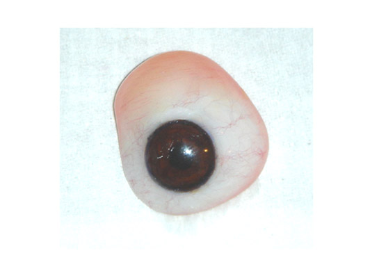 Large artificial eye designed to compensate for primary lack of volume in the socket